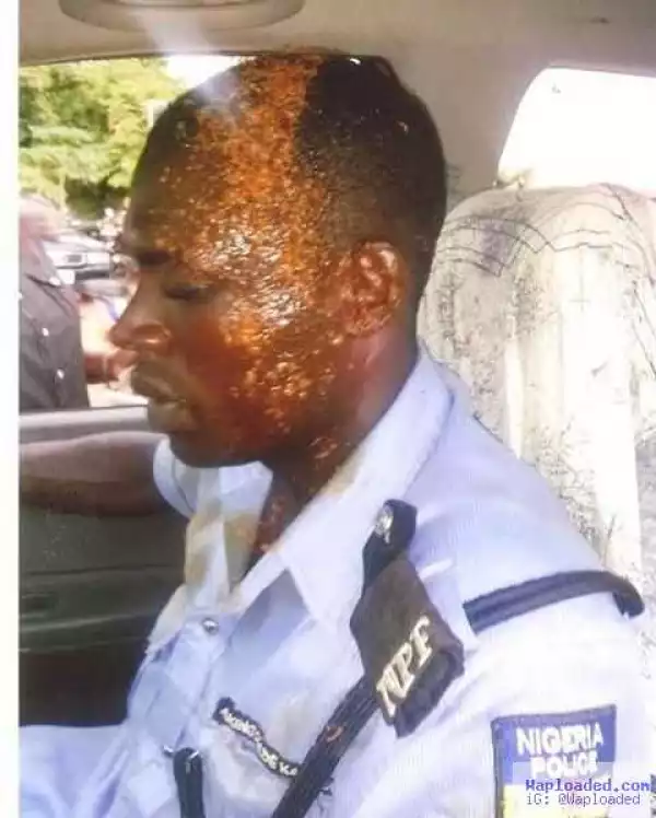 Photo:- Man Remanded In Prison For Pouring Hot Soup On Policeman